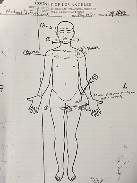 edwards-autopsy-sketch-img-v2